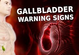 Image result for Bad Gallbladder Symptoms