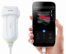 Image result for Portable Ultrasound Machine with iPhone
