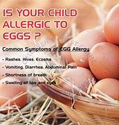 Image result for Egg Allergy Symptoms