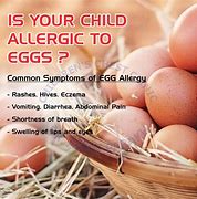 Image result for Egg Allergy Baby
