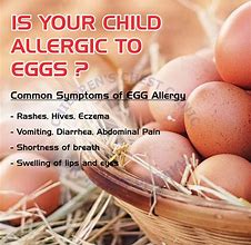 Image result for Egg Allergy