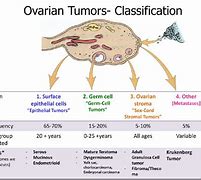 Image result for Ovarian Cancer Subtypes