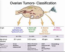 Image result for Philippine Ovarian Tumor
