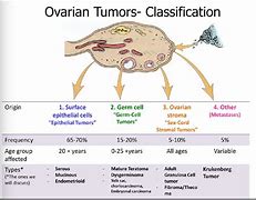 Image result for Epithelial Ovarian Cancer Types