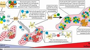 Image result for Type 1 Diabetes Pathophysiology