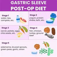 Image result for Gastric Bypass Diet Sample Menus