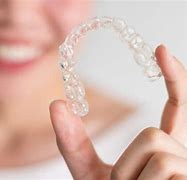 Image result for Byte Aligners Reviews and Pictures