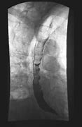 Image result for Radiology Christmas Nutcracker