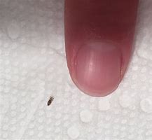 Image result for Bed Lice