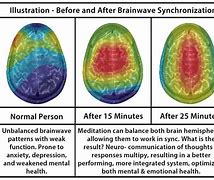 Image result for Meditation Brain Scan