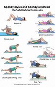 Image result for Post Lumbar Fusion Exercises