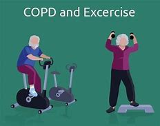 Image result for Physical Activity and Exercise in Cholilithiasis