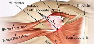 Image result for Rotator Cuff Bicep Pain