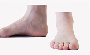 Image result for Feet Front View