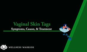 Image result for Genital Skin Tags