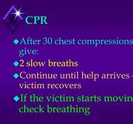 Image result for Recover CPR PowerPoint