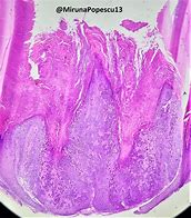 Image result for Horse Ear Warts