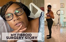 Image result for Large Fibroid Removal