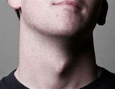 Image result for Guy with Adam's Apple