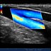 Image result for SonoSite Ultrasound Machine