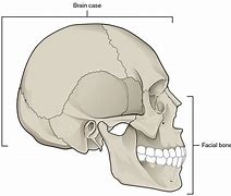 Image result for iPhone Case Skeleton DOOL
