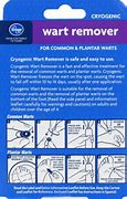 Image result for Cryo Wart Removal