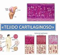 Image result for cartilaginodo