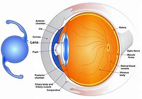 Image result for Intraocular Lenses for Cataract Surgery