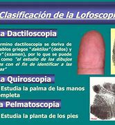 Image result for Lofoscopia
