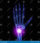 Image result for Omegs On Wrist