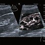 Image result for Ultrasound Application