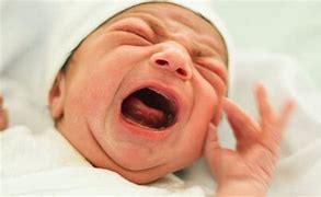 Image result for Baby Born without Face