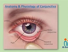 Image result for Pallor of Conjunctiva