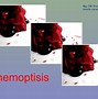 Image result for hemoptisis