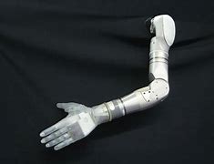 Image result for Robotic Arm Prosthetics