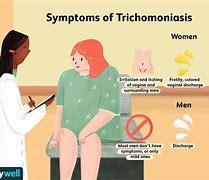 Image result for Trichomoniasis Symptoms Men