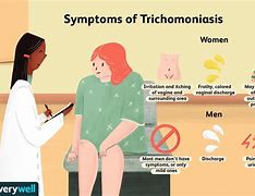 Image result for Trichomoniasis Look Like