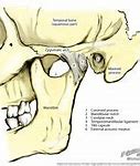 Image result for Jaw Joint Anatomy
