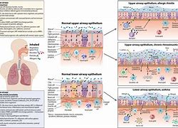 Image result for Infectious vs Inflammatory