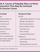 Image result for Most Common Benign Ovarian Tumor