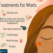 Image result for Common Warts