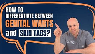 Image result for Causes of Genital Warts
