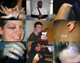 Image result for wii accidents