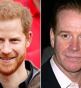 Image result for Side by Side Pictures of Prince Harry and Major James