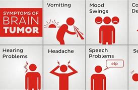 Image result for Brain Tumor Headache Symptoms