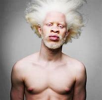 Image result for Albino Bat Aesthetic
