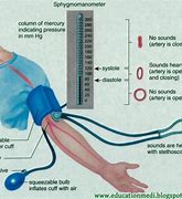Image result for Blood Pressure Measurement