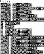 Image result for Intron DNA