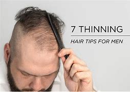 Image result for Thinning Hair Men Examples