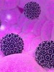 Image result for HPV Warts Disease